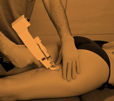 Ossigeno-Ozonoterapia-Mesoterapia (Terapie infiltrative)